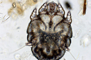 Chesoccal tick - kukac krstarenje ispod kože